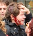 Niño herido 14n tarragona.jpg